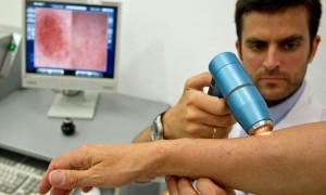 imagen-cancerdepiel